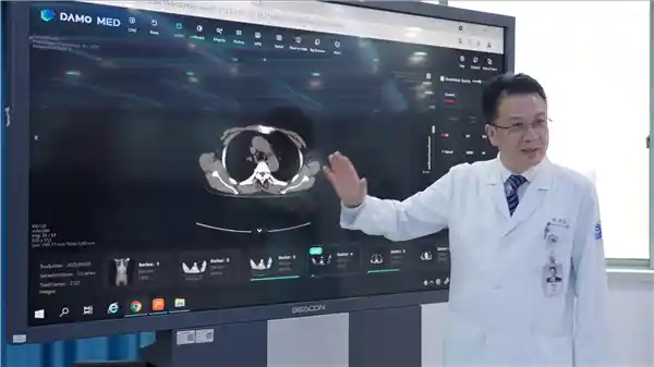 AI识癌新突破：阿里巴巴首创CT早筛胃癌黑科技