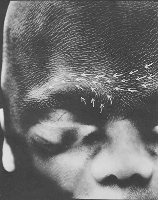 头发旋涡藏玄机：双旋人群真有‘智慧光环’？